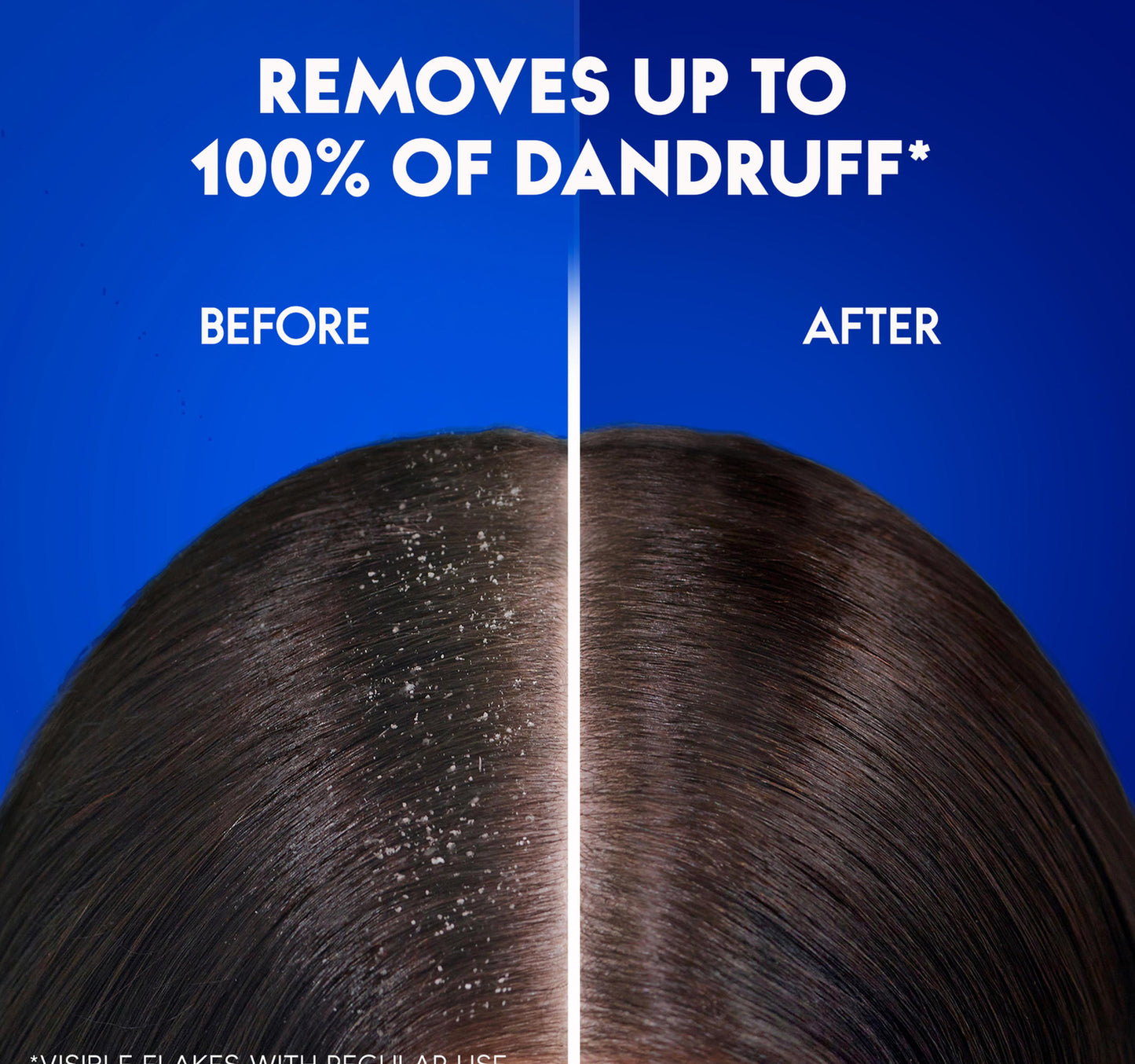 Head & Shoulders Classic Clean Anti-Dandruff Shampoo for Normal Hair 600 ml