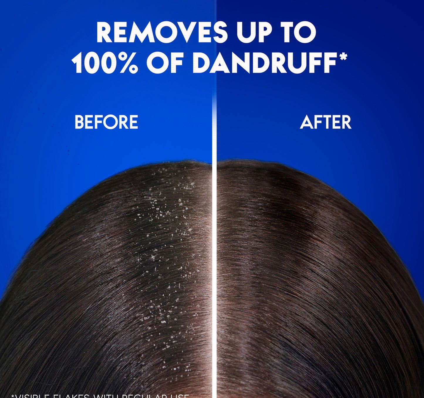 Head & Shoulders Classic Clean Anti-Dandruff Shampoo Value Pack 2 x 350 ml