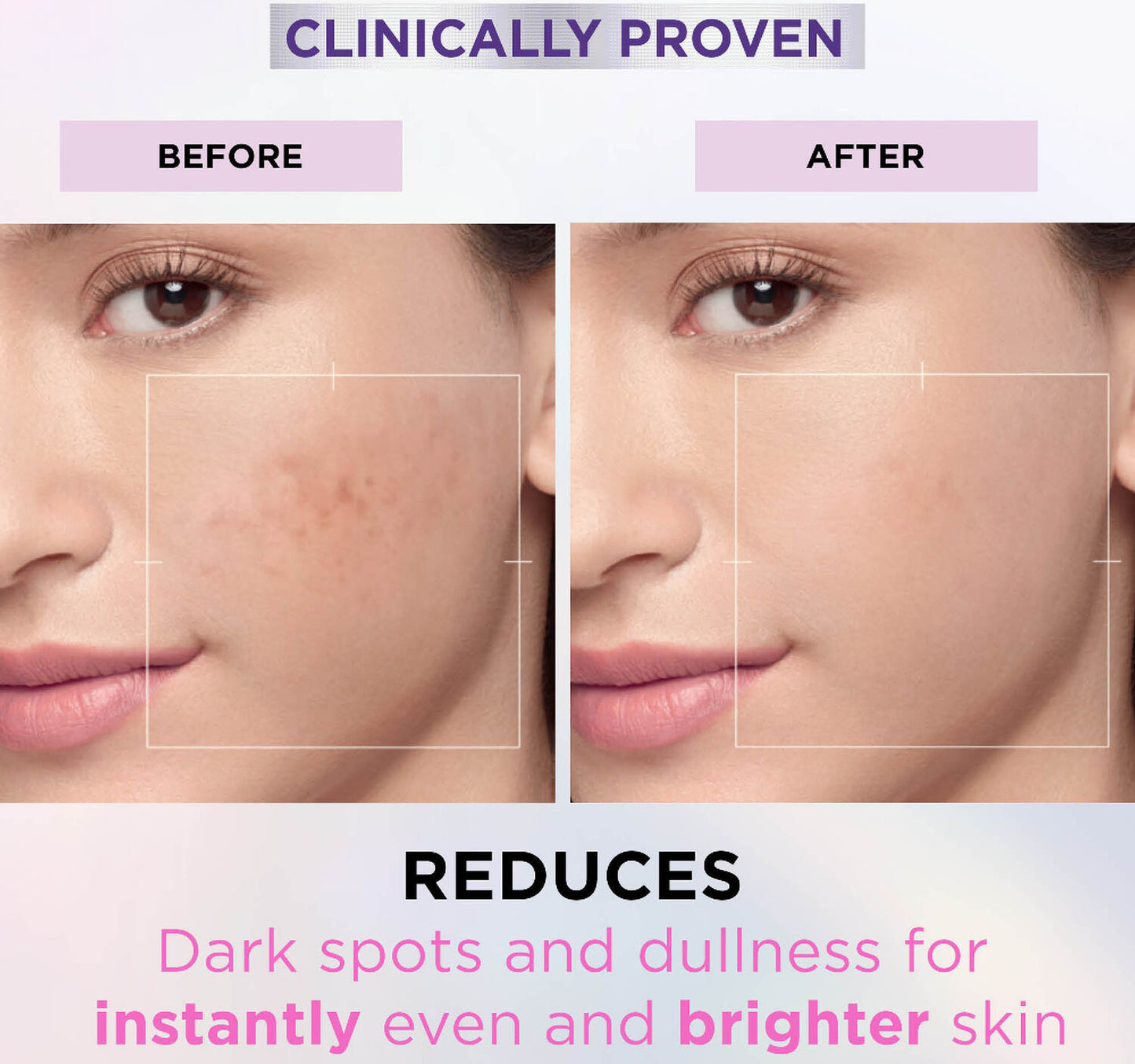 L'Oreal Paris Glycolic Bright Glow Serum 15 ml