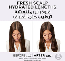 L'Oreal Paris Elvive Hyaluron Oil Erasing Scalp Serum 102 ml