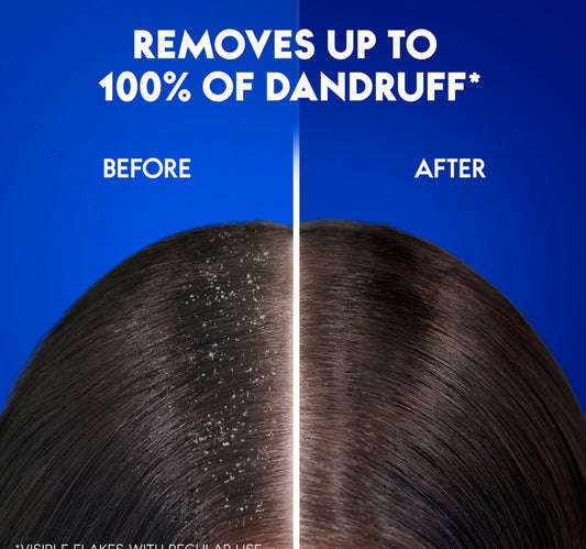 Head & Shoulders Classic Clean Anti-Dandruff Shampoo Value Pack 2 x 350 ml